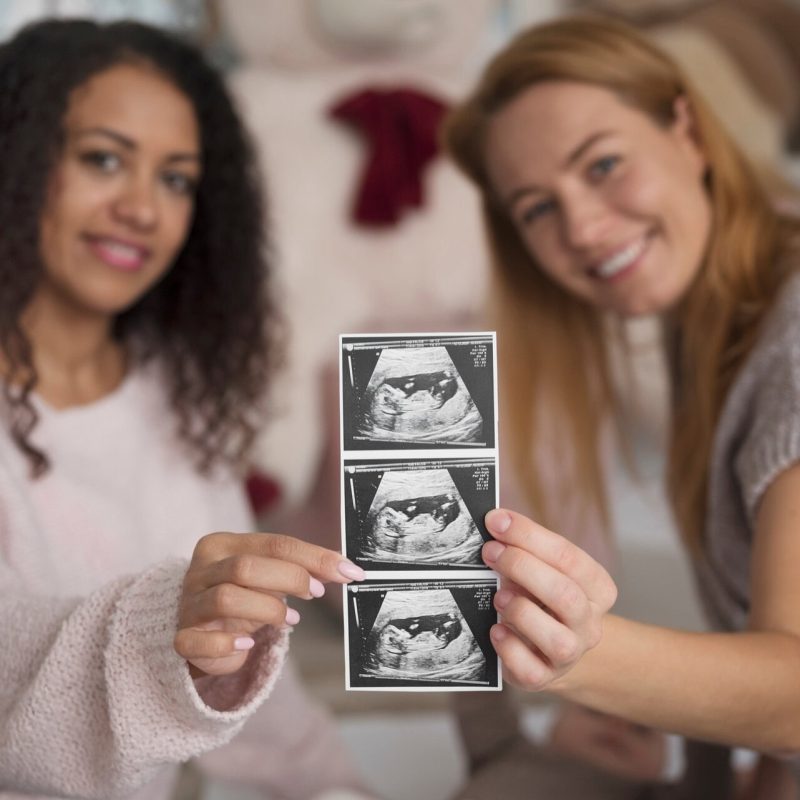 Surrogacy Journey surrogacy journey